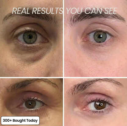 Instant Glow Under-Eye & Wrinkle Stick